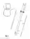 Fig. 04 - Device For Cutting Off And Removing Calcified Tissue From A Heart Valve