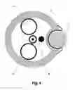 Fig. 05 - Device For Cutting Off And Removing Calcified Tissue From A Heart Valve