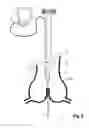 Fig. 07 - Device For Cutting Off And Removing Calcified Tissue From A Heart Valve