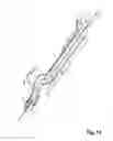 Fig. 13 - Device For Cutting Off And Removing Calcified Tissue From A Heart Valve