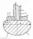 Fig. 01 - Surgical vaporization electrode