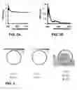 Fig. 04 - Selective fat removal using photothermal heating