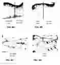 Fig. 08 - Selective fat removal using photothermal heating