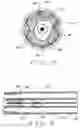 Fig. 04 - EXPANDABLE LASER CATHETER