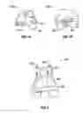 Fig. 02 - System and methods for positioning bone cut guide