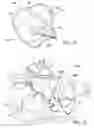 Fig. 19 - Method and apparatus for surgical navigation