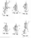 Fig. 11 - Robotized module for guiding an elongate flexible medical device