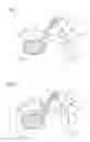 Fig. 02 - Medical robotic device and method for the operation thereof