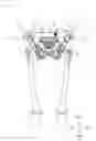Fig. 06 - Instrument for artificial knee joint replacement surgery, and instrument unit for artificial knee joint replacement surgery