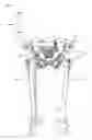 Fig. 09 - Instrument for artificial knee joint replacement surgery, and instrument unit for artificial knee joint replacement surgery