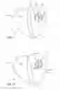 Fig. 08 - Assembly for positioning electrodes for radiofrequency tissue ablation