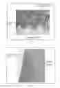 Fig. 07 - Dental Ring