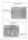 Fig. 08 - Dental Ring