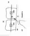 Fig. 06 - FLOSS THREADER