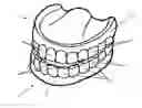 Fig. 01 - Dental prosthesis for determining abrasion facets