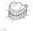 Fig. 02 - Dental prosthesis for determining abrasion facets
