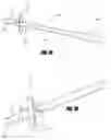Fig. 02 - Devices and systems for lung treatment