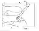 Fig. 01 - Soft anchor assembly with non-sliding flexible strand and techniques for use