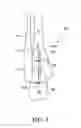 Fig. 05 - Transcortal bone joint fusion system