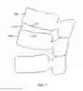 Fig. 02 - Expandable spinal implant apparatus and method of use