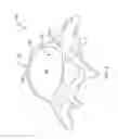 Fig. 03 - Expandable spinal implant apparatus and method of use