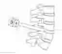 Fig. 01 - Method and apparatus for minimally invasive insertion of intervertebral implants