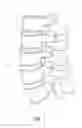 Fig. 02 - Method and apparatus for minimally invasive insertion of intervertebral implants