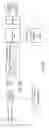 Fig. 10 - ROBUST SWING LEG CONTROLLER UNDER LARGE DISTURBANCES