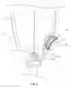 Fig. 03 - LANYARD SYSTEMS FOR PROSTHETIC DEVICES AND RELATED METHODS