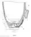 Fig. 06 - LANYARD SYSTEMS FOR PROSTHETIC DEVICES AND RELATED METHODS