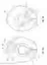 Fig. 17 - LANYARD SYSTEMS FOR PROSTHETIC DEVICES AND RELATED METHODS