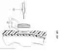 Fig. 45 - LANYARD SYSTEMS FOR PROSTHETIC DEVICES AND RELATED METHODS