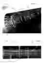 Fig. 03 - Stents having a hybrid pattern and methods of manufacture
