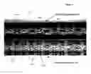 Fig. 04 - Stents having a hybrid pattern and methods of manufacture