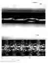Fig. 07 - Stents having a hybrid pattern and methods of manufacture