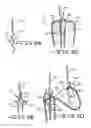 Fig. 08 - LOADING APPARATUS AND SYSTEM FOR EXPANDABLE INTRALUMINAL MEDICAL DEVICES