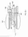 Fig. 12 - Sheath capture device for stent graft delivery system and method for operating same