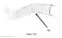 Fig. 03 - Control device for controlling a rigidity of an orthosis and method of controlling a rigidity of an orthosis