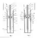 Fig. 02 - ORTHOPEDIC DEVICE FOR LIMITING THE MOVEMENT OF A JOINT ARRANGED BETWEEN A FIRST AND A SECOND BODY REGION
