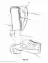 Fig. 15 - ORTHOPEDIC DEVICE FOR LIMITING THE MOVEMENT OF A JOINT ARRANGED BETWEEN A FIRST AND A SECOND BODY REGION