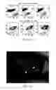 Fig. 13 - Methods and systems for tracking a torsional orientation and position of an eye