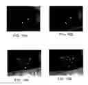 Fig. 17 - Methods and systems for tracking a torsional orientation and position of an eye