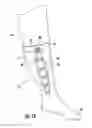 Fig. 12 - Compression garment