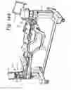 Fig. 138 - Patient positioning support apparatus with virtual pivot-shift pelvic pads, upper body stabilization and fail-safe table attachment mechanism