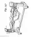 Fig. 141 - Patient positioning support apparatus with virtual pivot-shift pelvic pads, upper body stabilization and fail-safe table attachment mechanism