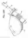 Fig. 259 - Patient positioning support apparatus with virtual pivot-shift pelvic pads, upper body stabilization and fail-safe table attachment mechanism