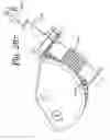 Fig. 260 - Patient positioning support apparatus with virtual pivot-shift pelvic pads, upper body stabilization and fail-safe table attachment mechanism