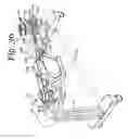 Fig. 37 - Patient positioning support apparatus with virtual pivot-shift pelvic pads, upper body stabilization and fail-safe table attachment mechanism