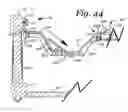 Fig. 45 - Patient positioning support apparatus with virtual pivot-shift pelvic pads, upper body stabilization and fail-safe table attachment mechanism