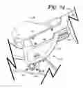 Fig. 74 - Patient positioning support apparatus with virtual pivot-shift pelvic pads, upper body stabilization and fail-safe table attachment mechanism